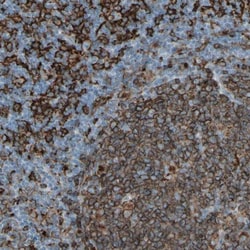 HLA DPB1 Antibody, Novus Biologicals 25 &mu;L; Unlabeled:Antibodies, Polyclonal